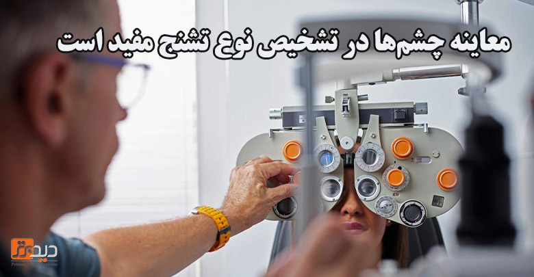 تشخیص تشنج از روی معاینه چشم