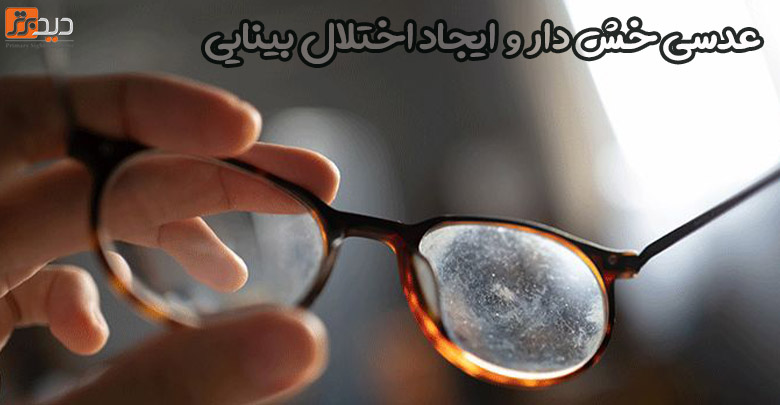 خش و خط عینک ممکن است  پرتوهای نوری را منحرف کرده ودر فرد ایجاد اختلال بینایی کند.