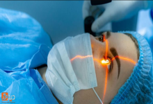 پنج باور اشتباه درباره‌ی جراحی لیزیک چشم