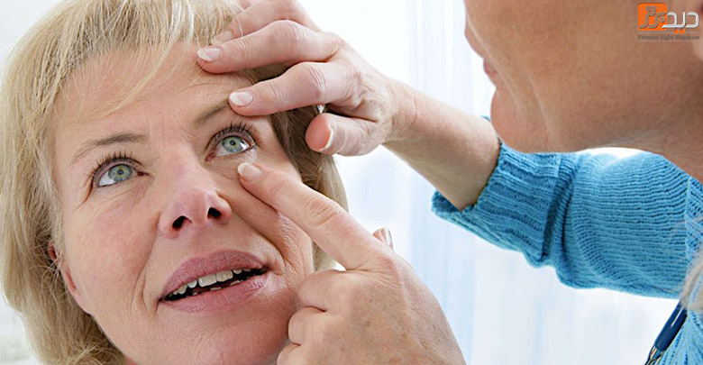 سلامت چشم زنان